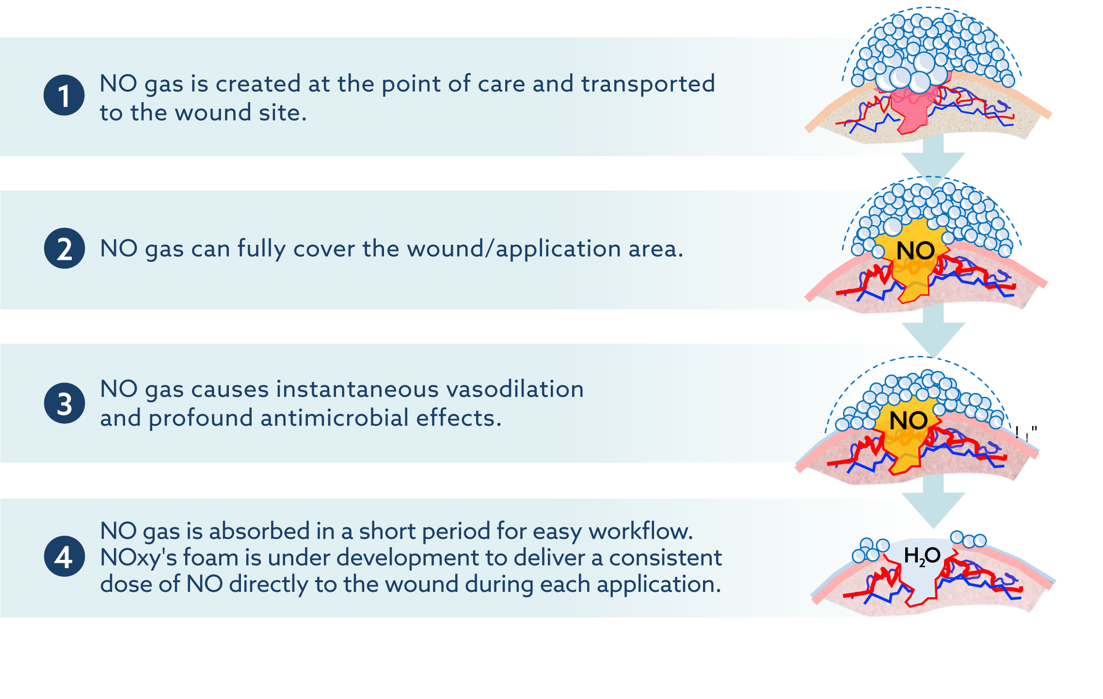 How NOxy's point-of-care foam platform is designed to work